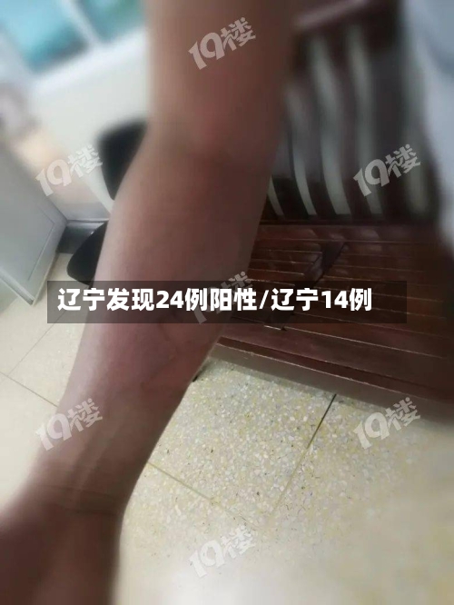 辽宁发现24例阳性/辽宁14例-第3张图片